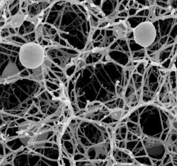 冷冻扫描电镜测试